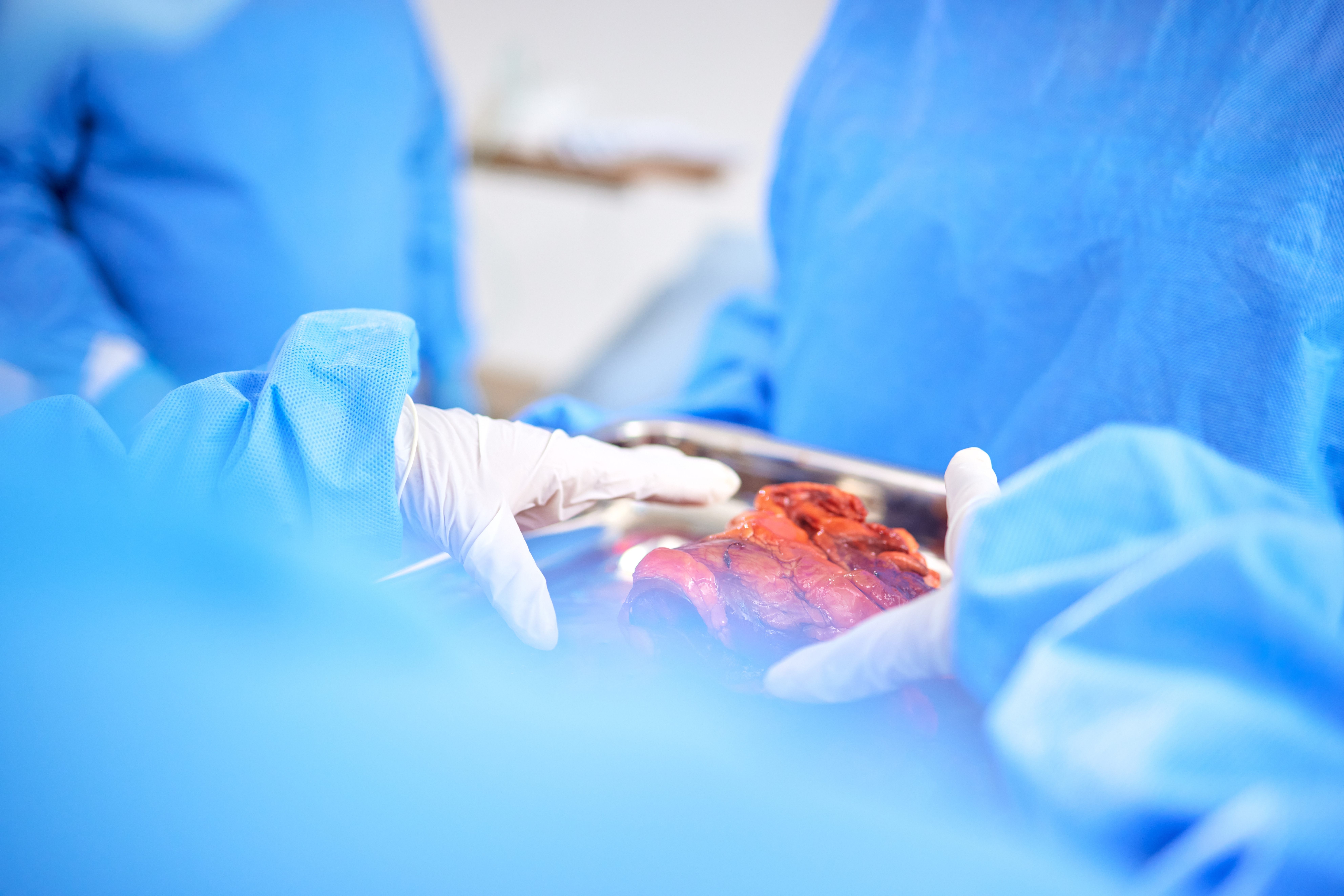 Lung transplant process